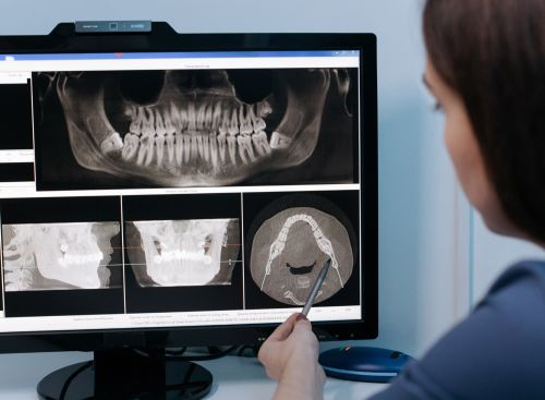 Rayos X Dentales de Alta Precisión en Barcelona 